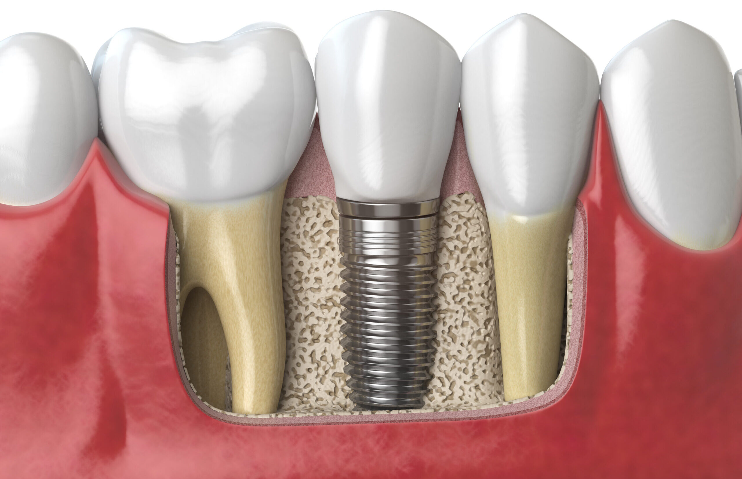 anatomy of healthy teeth and tooth dental implant PAF6ZMW scaled e1615819547276