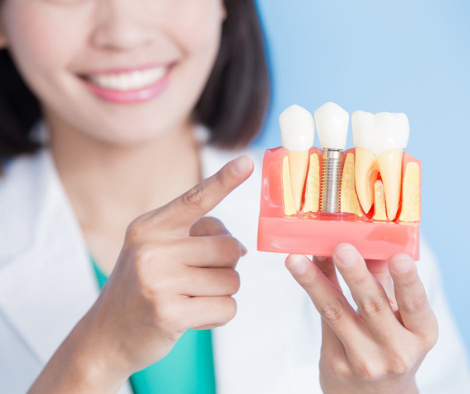 Steps Of Placing A Dental Crown