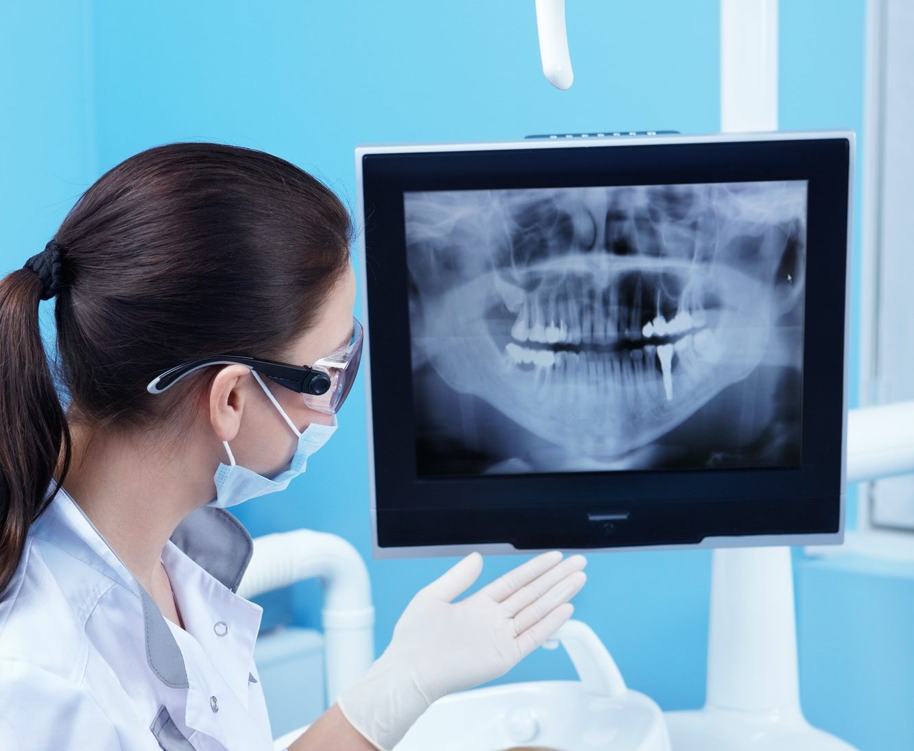 Dental X-ray of the patient